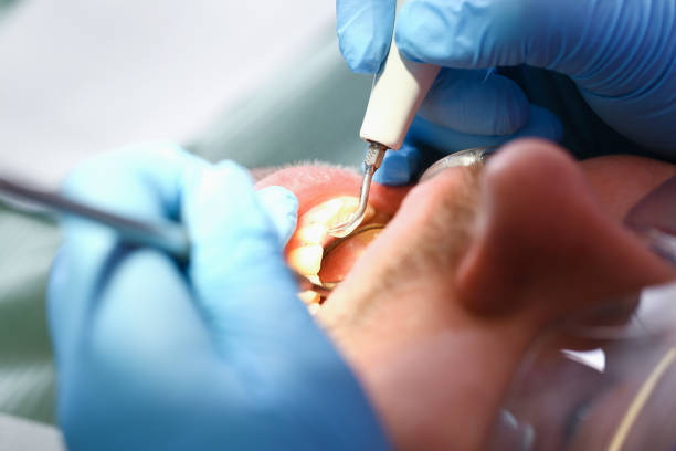 Best Pediatric Emergency Dentist in Ashtabula, OH