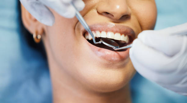 Best Emergency Broken Tooth Repair in Ashtabula, OH